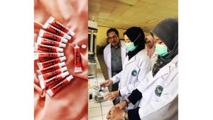 Tim Peneliti Unja Temukan Formula Pasta Gigi Hipersensitive Pada Perokok