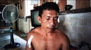 Sedang Tidur di Rumah Teman, Warga Rantau Panjang Ditikam