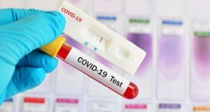 Jalani Rapid Test Dulu Baru Masuk Asrama