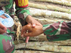 Satgas TMMD Disengat Tawon Saat Pembukaan Jalan di Sungai Terap