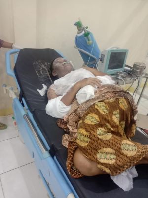 Disambar Api dari Lampu Teplok, Nenek Alami luka Bakar di Muka hingga Tangan