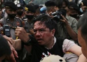 IPW Desak Polisi Ungkap Pihak-pihak di Balik Pemukulan Ade Armando
