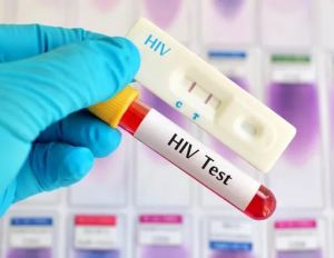 222 Kasus Baru HIV/AIDS Mucul di Jambi, Berikut Tantangan, Target - Keberhasilan Terapi ARV